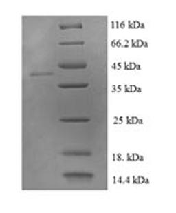 (Tris-Glycine gel) Discontinuous SDS-PAGE (reduced) with 5% enrichment gel and 15% separation gel.