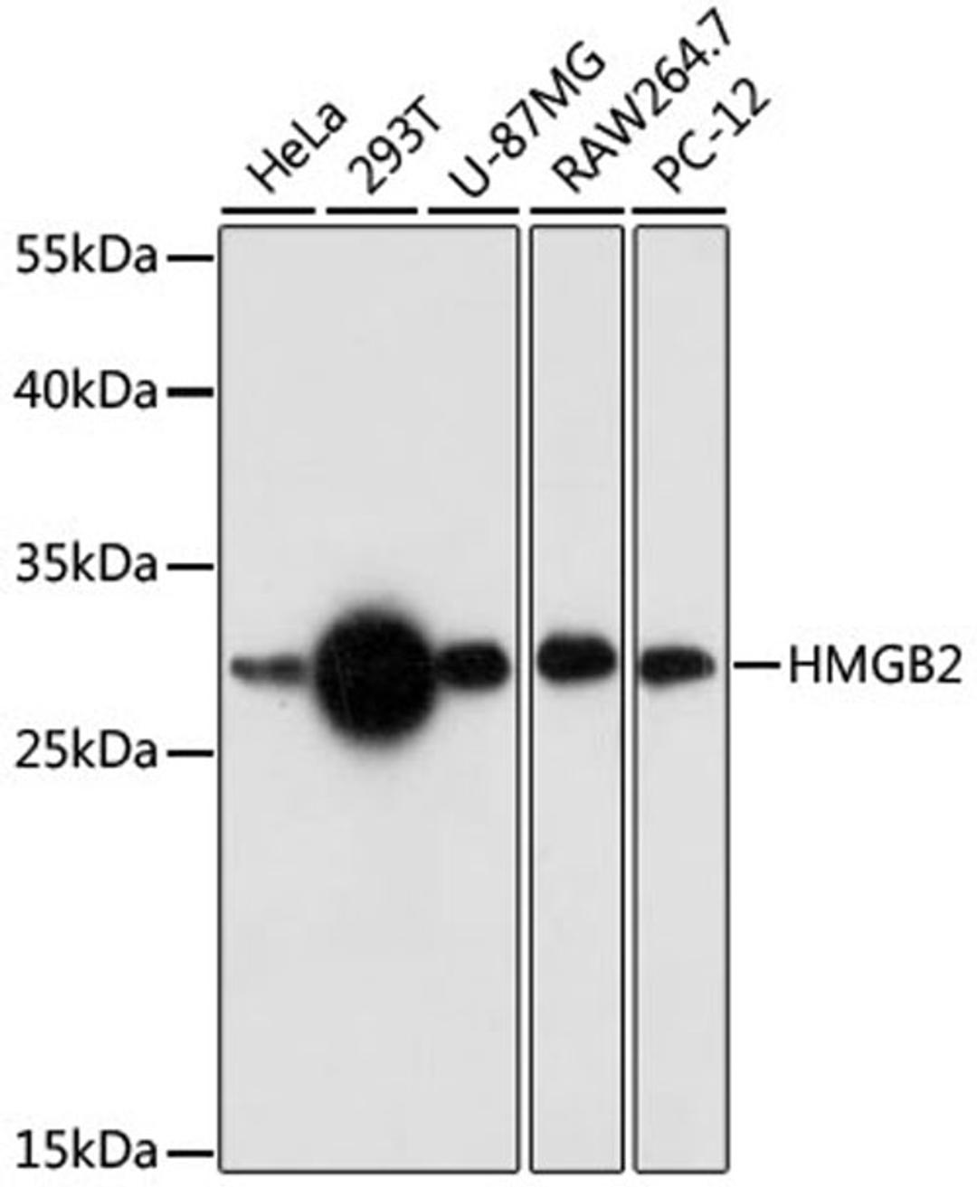 Western blot - HMGB2 antibody (A17360)