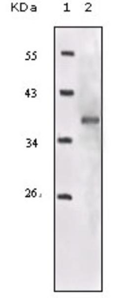 Western Blot: IGF-I R Antibody (3G5C1) [NB110-87052] - Analysis using IGF1R-Beta mouse mAb against truncated IGF1R recombinant protein.