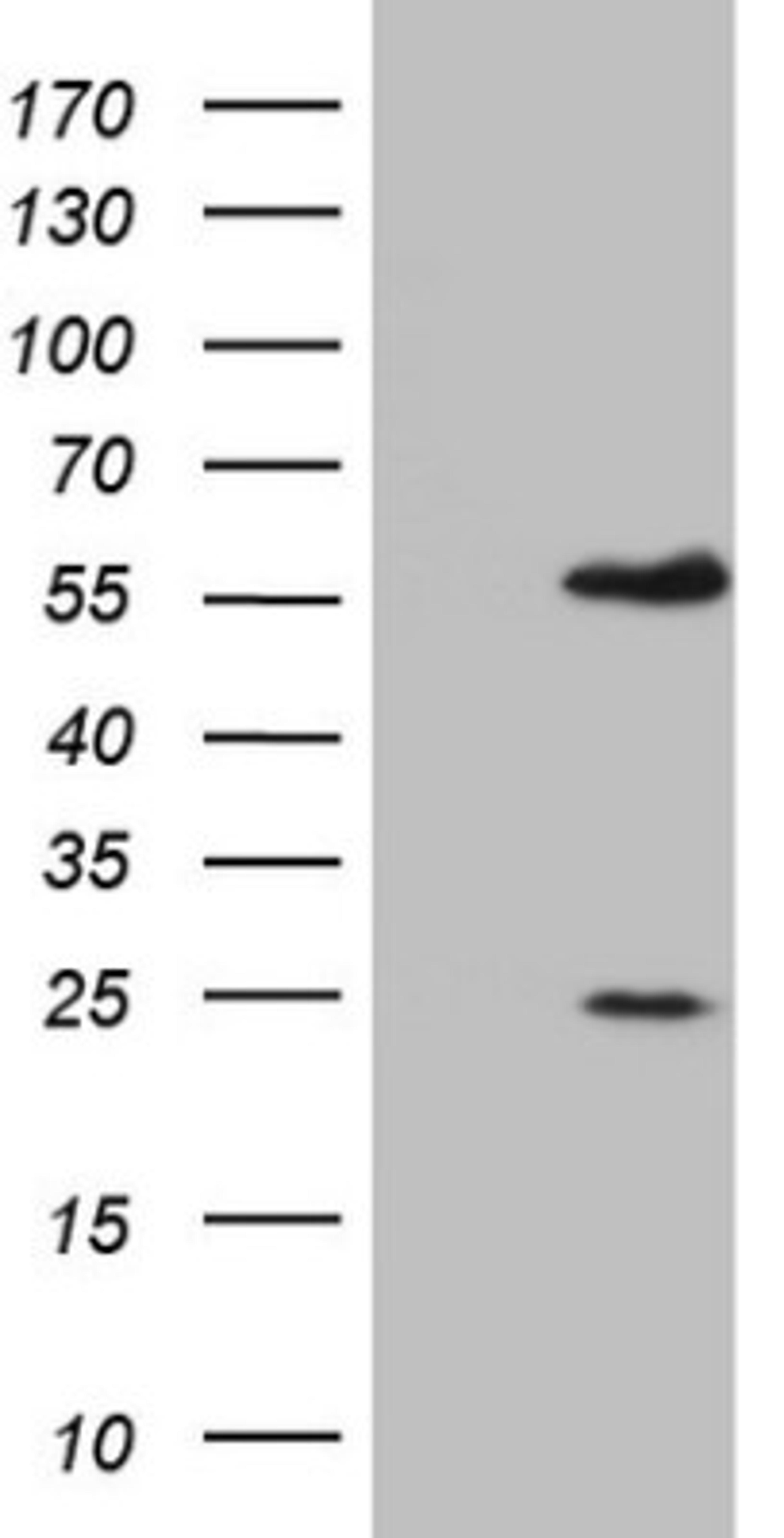 Western Blot: MNDA Antibody (4H6) [NBP2-45907] - Analysis of HEK293T cells were transfected with the pCMV6-ENTRY control (Left lane) or pCMV6-ENTRY MNDA.