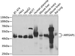 Western blot - ARFGAP1 antibody (A7118)