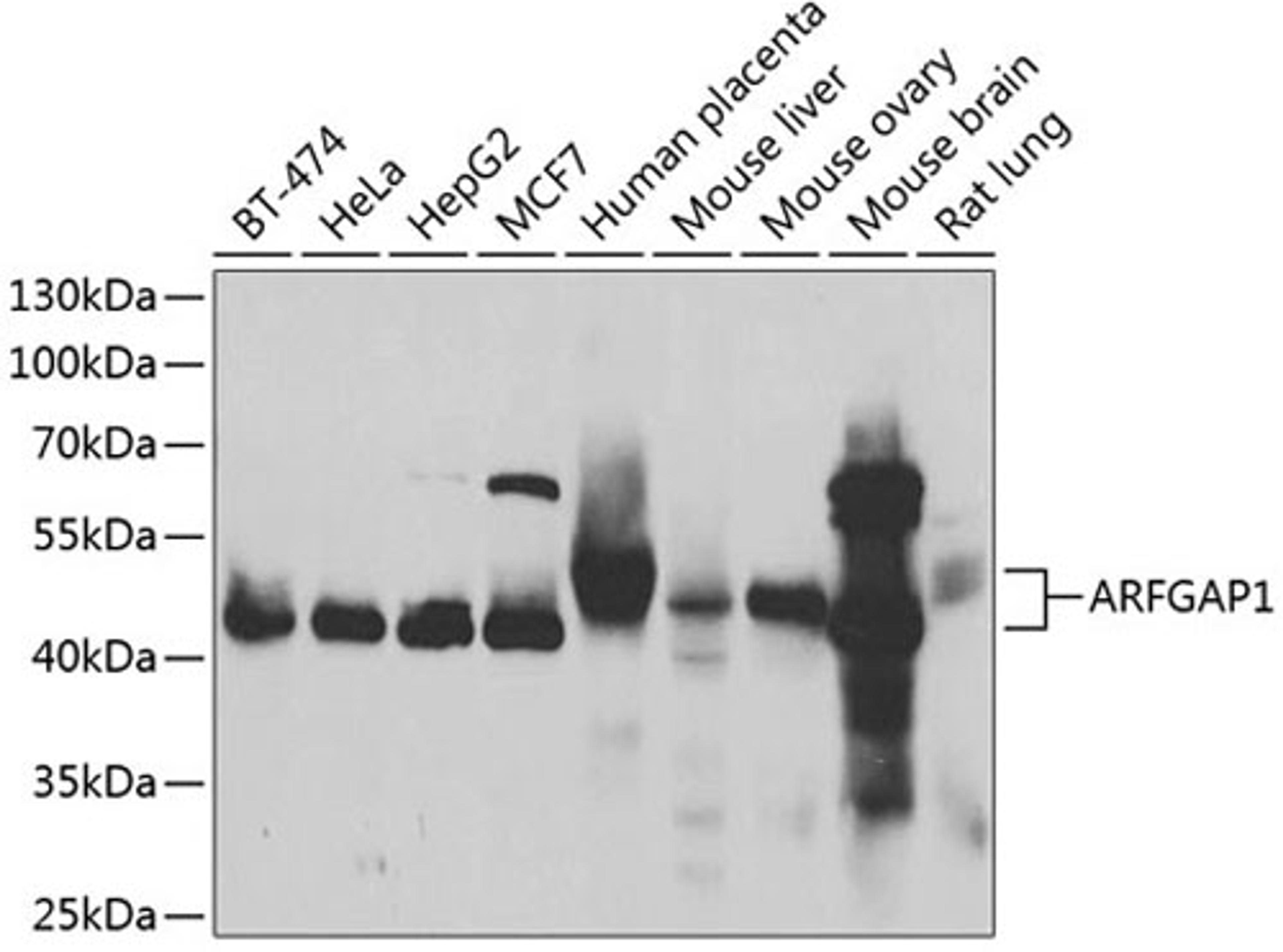 Western blot - ARFGAP1 antibody (A7118)