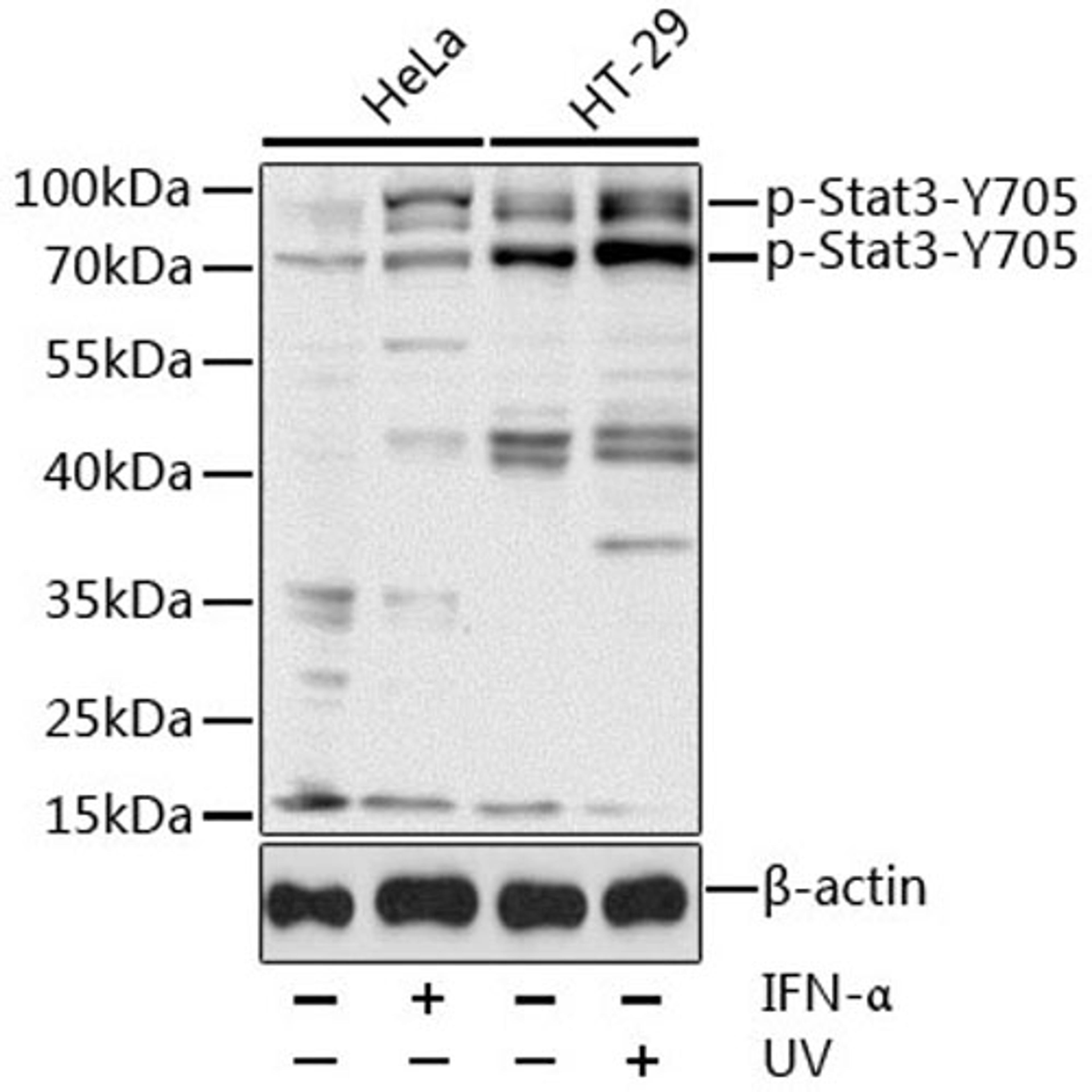 Western blot - Phospho-Stat3-Y705 antibody (AP0070)