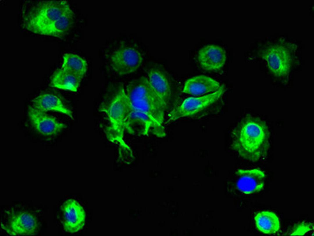 Immunofluorescent analysis of MCF-7 cells using CSB-PA021480LA01HU at dilution of 1:100 and Alexa Fluor 488-congugated AffiniPure Goat Anti-Rabbit IgG(H+L)