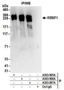 Detection of human RRBP1 by western blot of immunoprecipitates.