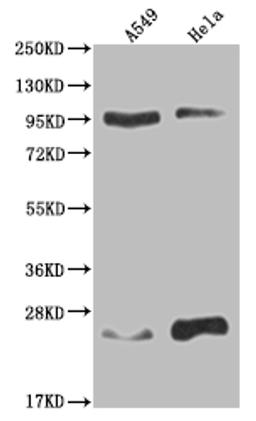 Western Blot. Positive WB detected in: A549 whole cell lysate, Hela whole cell lysate. All lanes: KDM1B antibody at 1:2000. Secondary. Goat polyclonal to rabbit IgG at 1/50000 dilution. Predicted band size: 93, 66, 20 kDa. Observed band size: 90-95, 17-28 kDa.