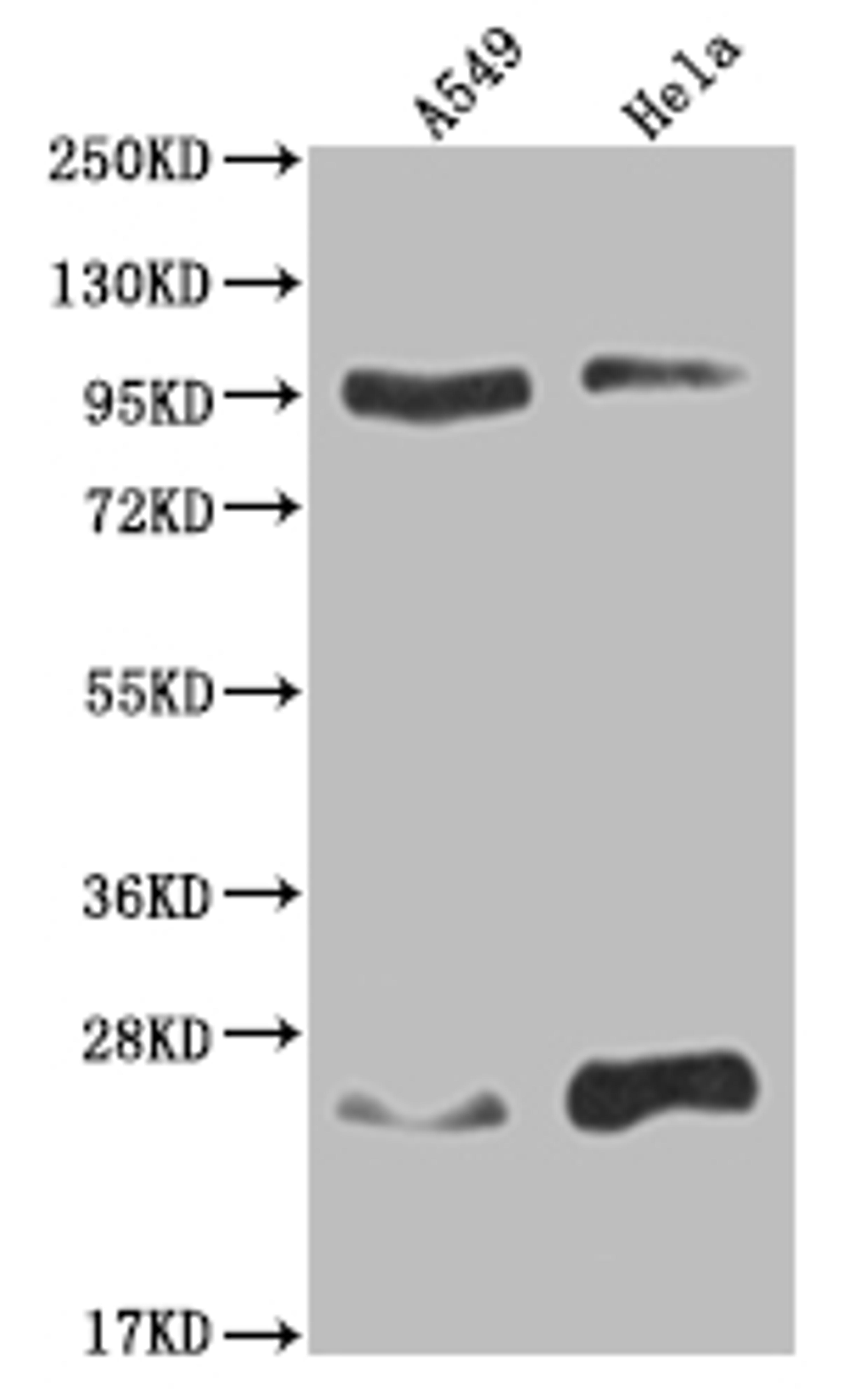 Western Blot. Positive WB detected in: A549 whole cell lysate, Hela whole cell lysate. All lanes: KDM1B antibody at 1:2000. Secondary. Goat polyclonal to rabbit IgG at 1/50000 dilution. Predicted band size: 93, 66, 20 kDa. Observed band size: 90-95, 17-28 kDa.