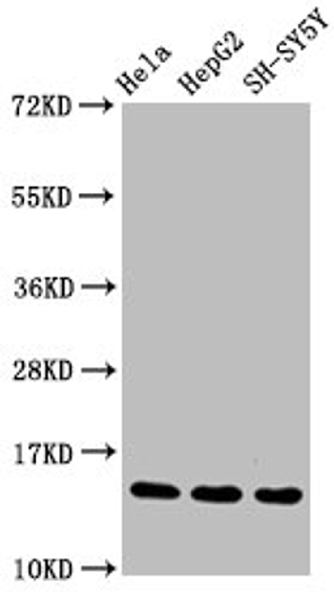 Western Blot. Positive WB detected in Hela whole cell lysate锛孒epG2 whole cell lysate锛孲H-SY5Y whole cell lysate. All lanes Mono-methyl-Histone H3.1(R17)antibody at 1.55μg/ml. Secondary. Goat polyclonal to rabbit IgG at 1/50000 dilution. Predicted band size: 15 KDa. Observed band size: 15 KDa. 