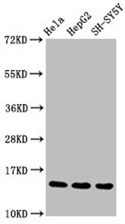 Western Blot. Positive WB detected in Hela whole cell lysate锛孒epG2 whole cell lysate锛孲H-SY5Y whole cell lysate. All lanes Mono-methyl-Histone H3.1(R17)antibody at 1.55μg/ml. Secondary. Goat polyclonal to rabbit IgG at 1/50000 dilution. Predicted band size: 15 KDa. Observed band size: 15 KDa. 