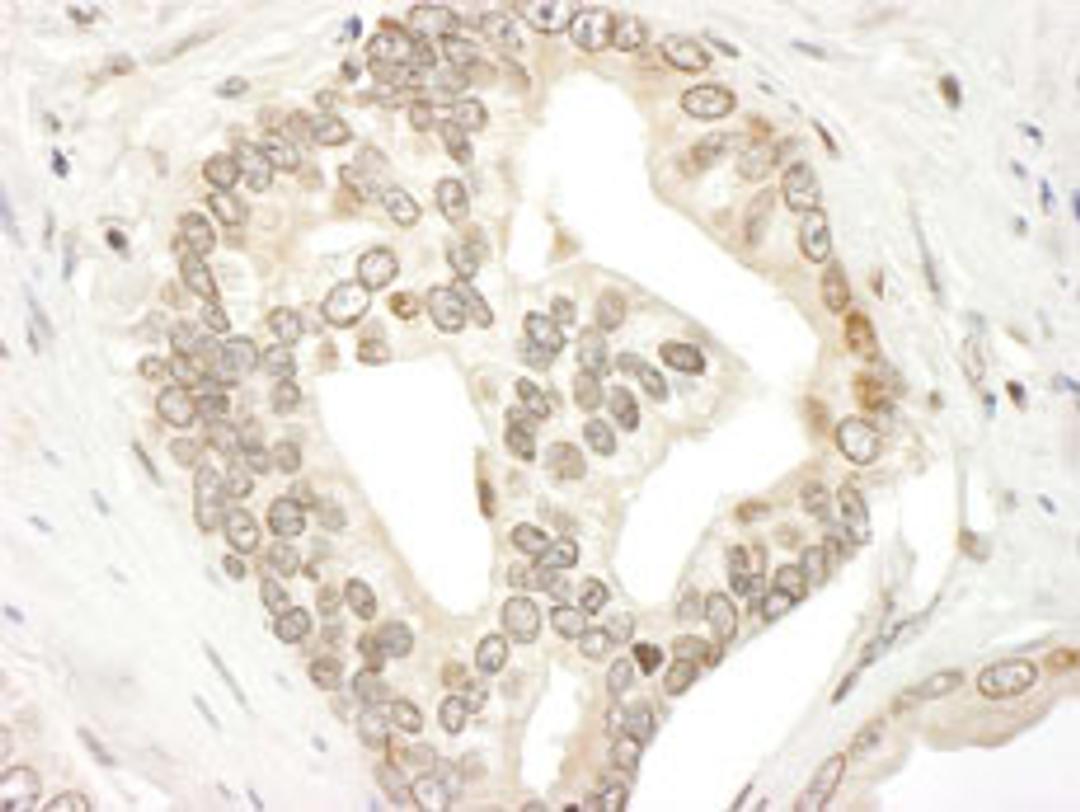 Detection of human JAK2 by immunohistochemistry.