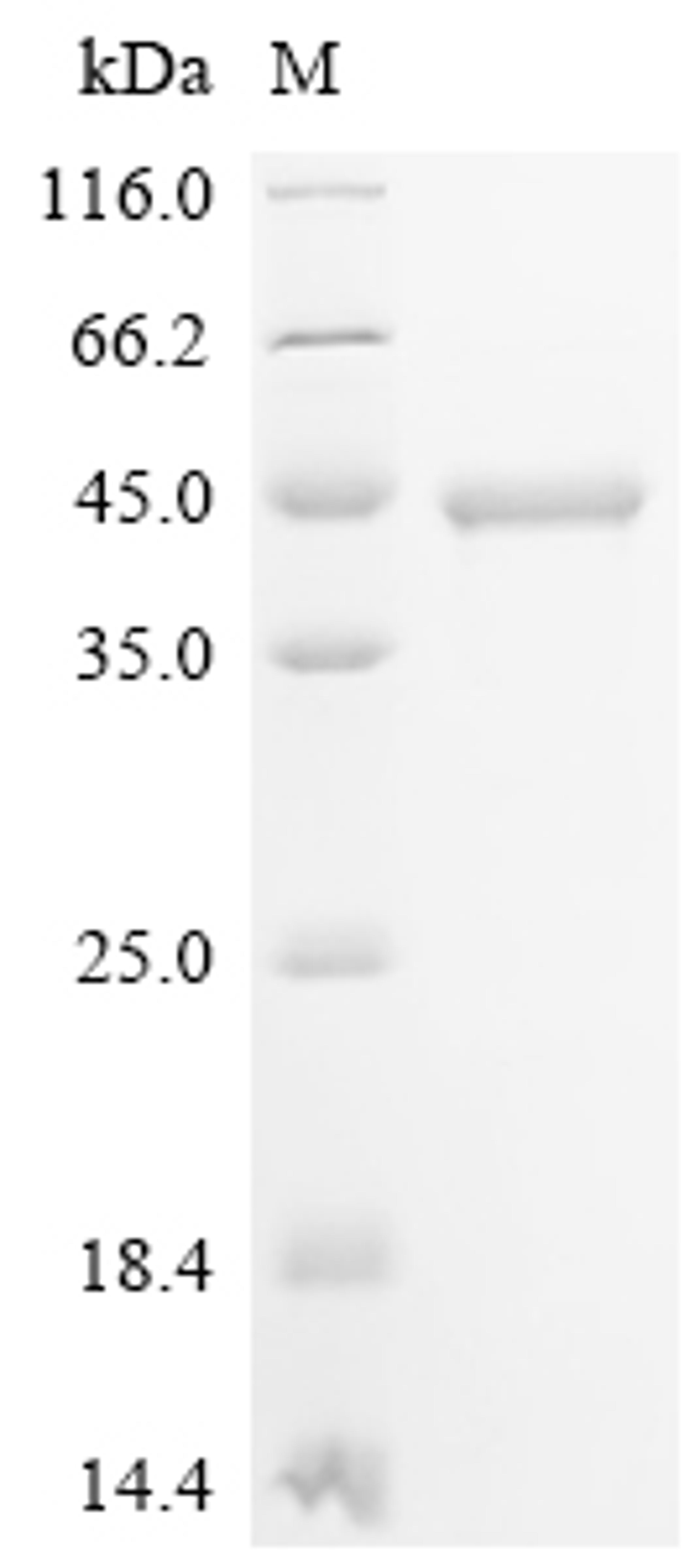 (Tris-Glycine gel) Discontinuous SDS-PAGE (reduced) with 5% enrichment gel and 15% separation gel.