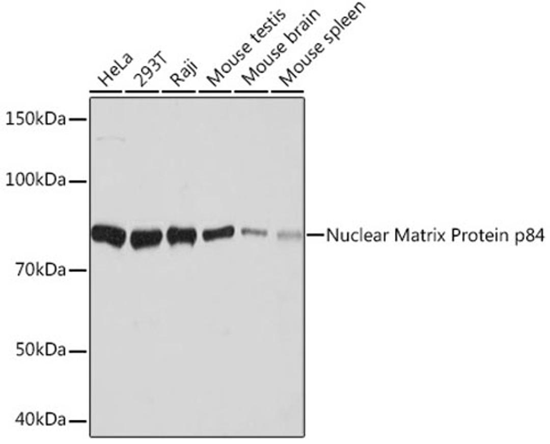 Western blot - Nuclear Matrix Protein p84 Rabbit mAb (A9269)