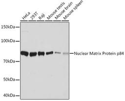 Western blot - Nuclear Matrix Protein p84 Rabbit mAb (A9269)