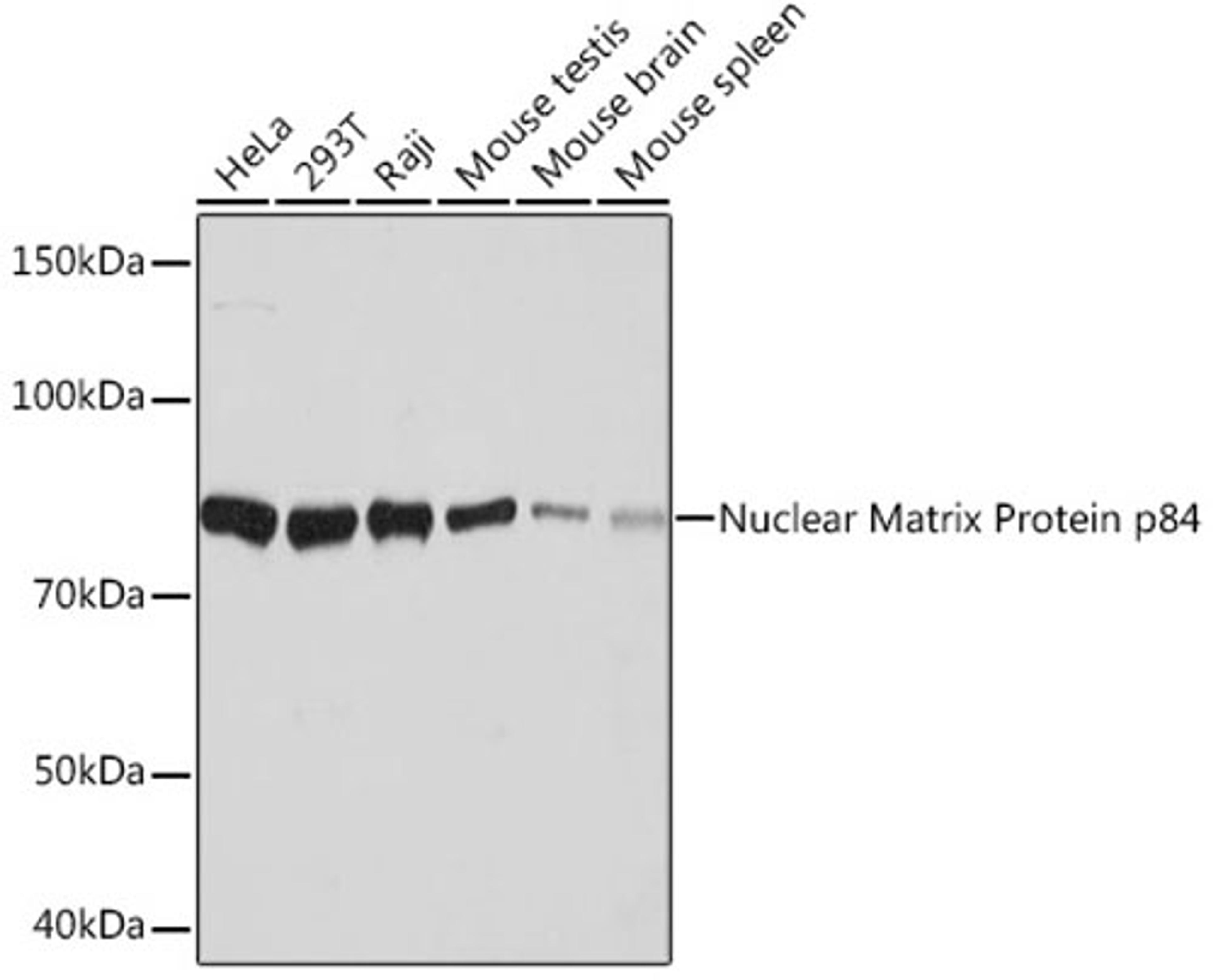 Western blot - Nuclear Matrix Protein p84 Rabbit mAb (A9269)