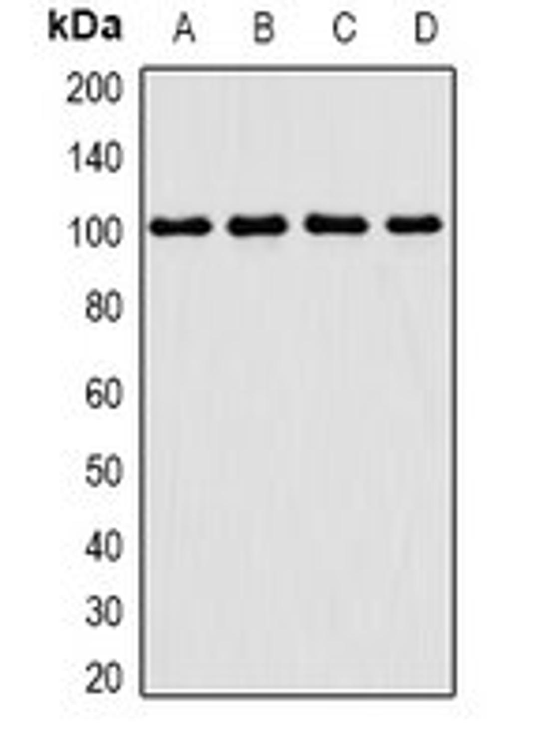 Western blot analysis of Jurkat (Lane1), MCF7 (Lane2), mouse thymus (Lane3), mouse testis (Lane4) whole cell lysates using TGS1 antibody