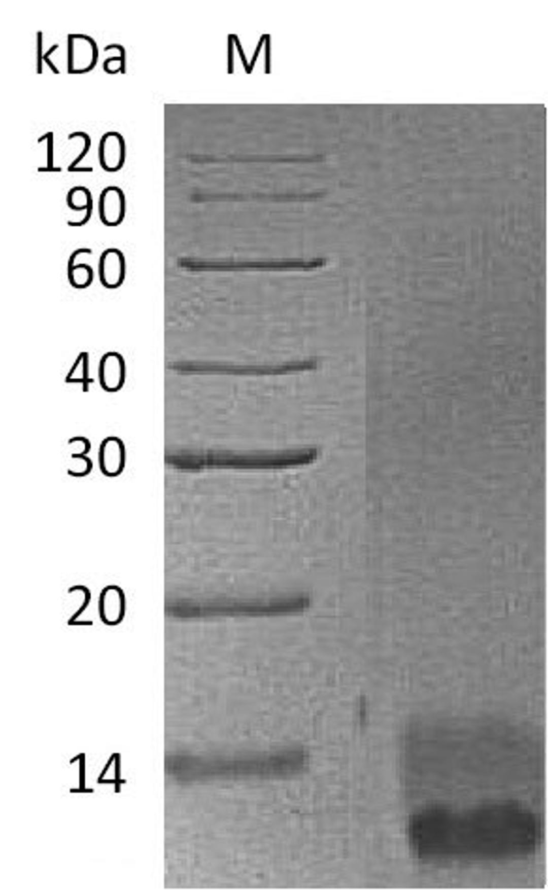 (Tris-Glycine gel) Discontinuous SDS-PAGE (reduced) with 5% enrichment gel and 15% separation gel.