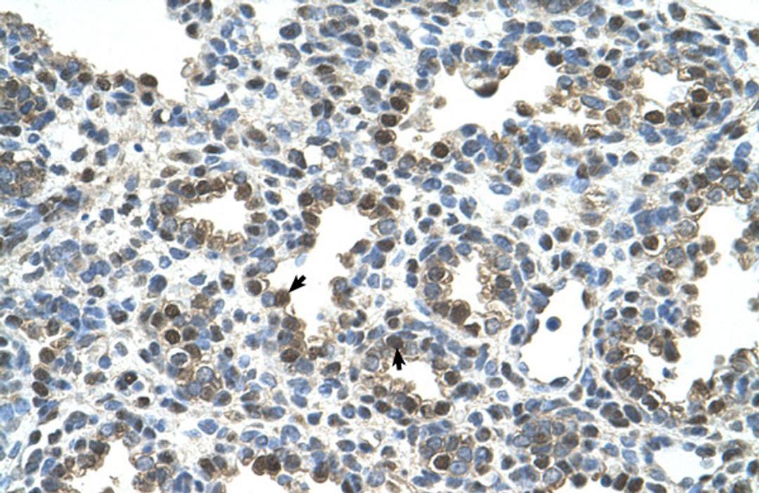 Antibody used in IHC on Human Lung.