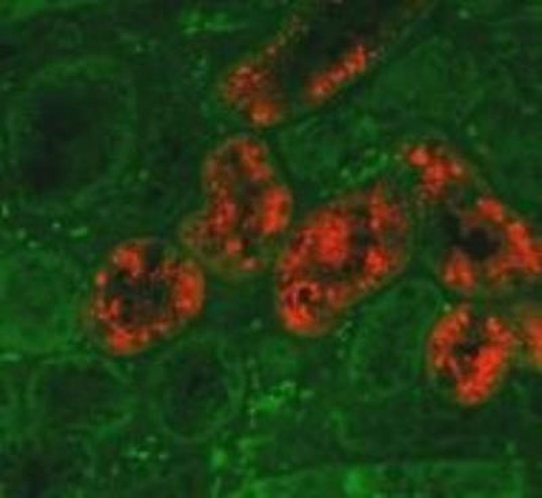 Immunohistochemistry: Lipocalin-2/NGAL Antibody (29) [NBP1-05183] - NGAL expression in the ischemia-reperfusion injured mouse kidney; detected with anti-mouse NGAL antibody at dilution of 1:1000. Image and data supplied by Prof. Gueler, Medizinische Hochschule Hannover.