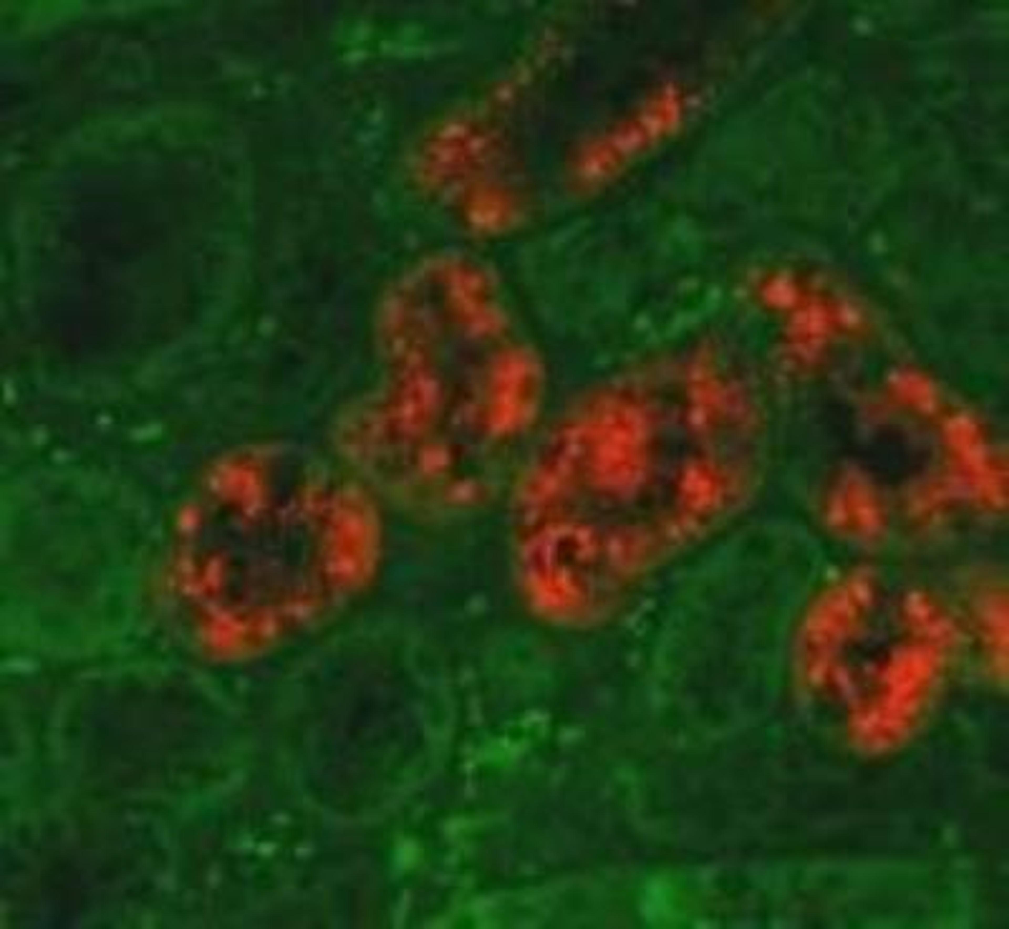 Immunohistochemistry: Lipocalin-2/NGAL Antibody (29) [NBP1-05183] - NGAL expression in the ischemia-reperfusion injured mouse kidney; detected with anti-mouse NGAL antibody at dilution of 1:1000. Image and data supplied by Prof. Gueler, Medizinische Hochschule Hannover.