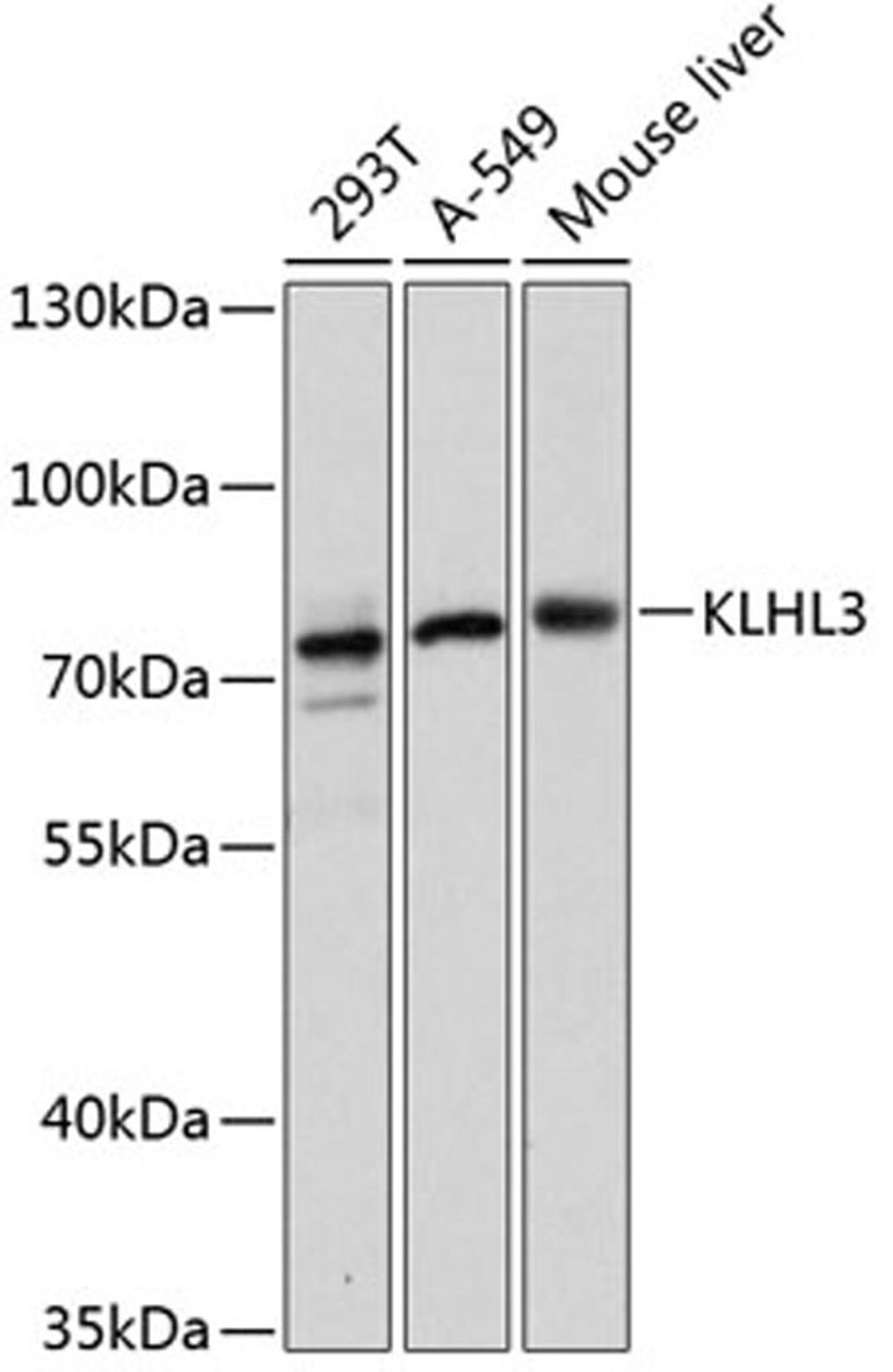 Western blot - KLHL3 antibody (A13771)