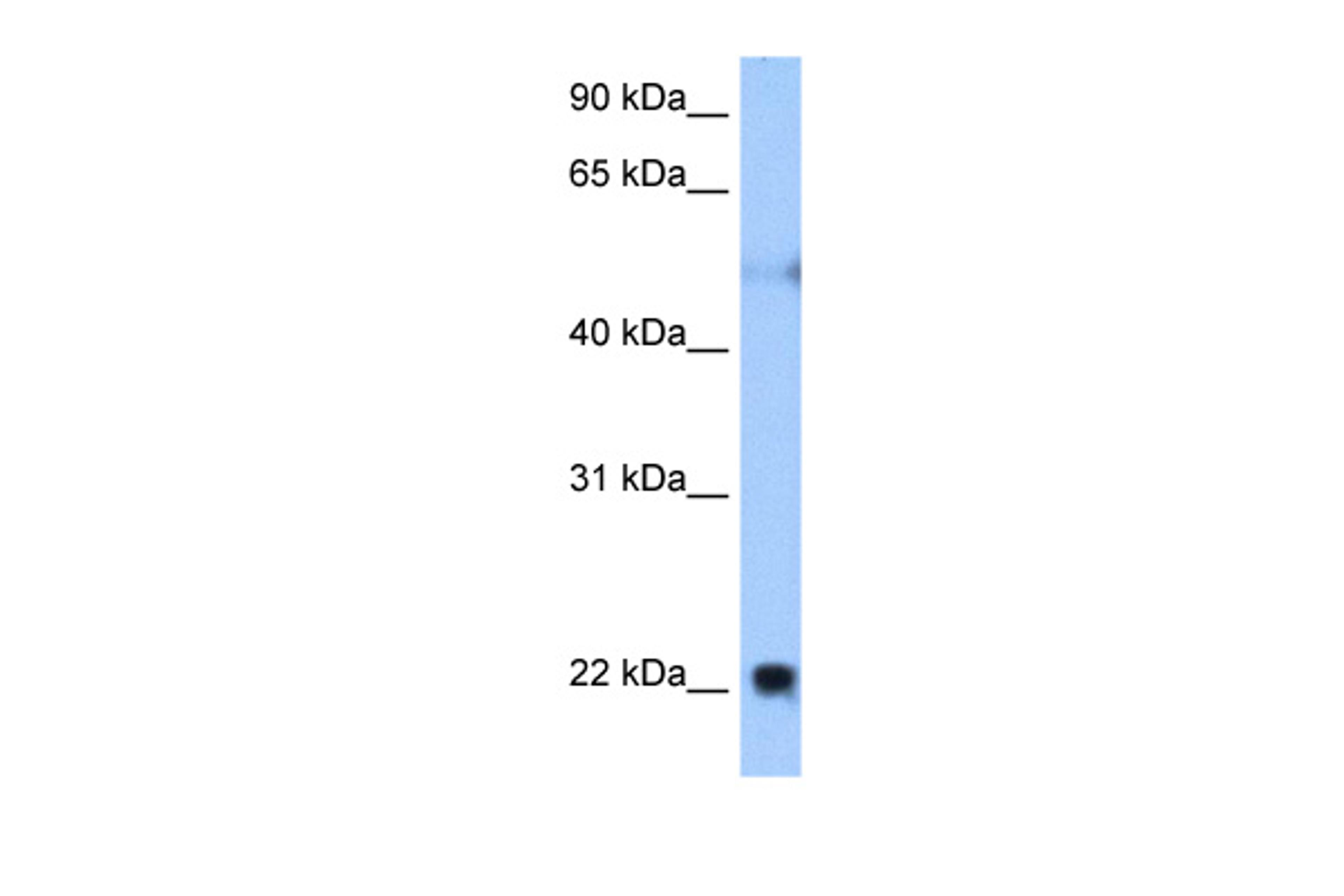 Antibody used in WB on Human Muscle at 0.2-1 ug/ml.