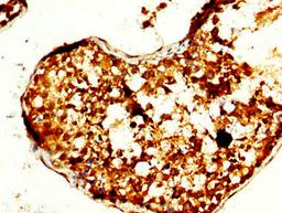 IHC image of CSB-PA024044LA01HU diluted at 1:240 and staining in paraffin-embedded human testis tissue performed on a Leica BondTM system. After dewaxing and hydration, antigen retrieval was mediated by high pressure in a citrate buffer (pH 6.0). Section was blocked with 10% normal goat serum 30min at RT. Then primary antibody (1% BSA) was incubated at 4°C overnight. The primary is detected by a biotinylated secondary antibody and visualized using an HRP conjugated SP system.