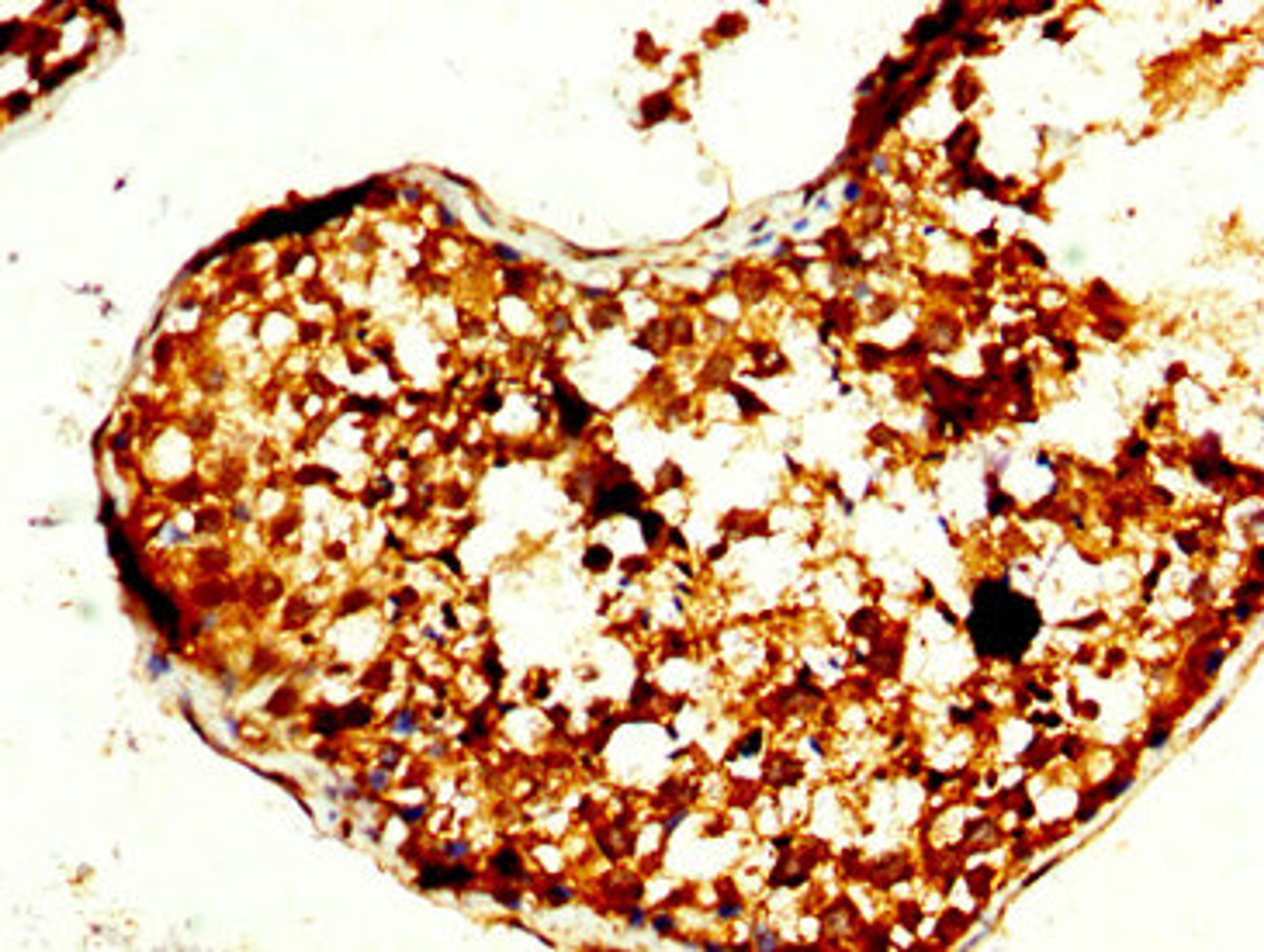 IHC image of CSB-PA024044LA01HU diluted at 1:240 and staining in paraffin-embedded human testis tissue performed on a Leica BondTM system. After dewaxing and hydration, antigen retrieval was mediated by high pressure in a citrate buffer (pH 6.0). Section was blocked with 10% normal goat serum 30min at RT. Then primary antibody (1% BSA) was incubated at 4°C overnight. The primary is detected by a biotinylated secondary antibody and visualized using an HRP conjugated SP system.