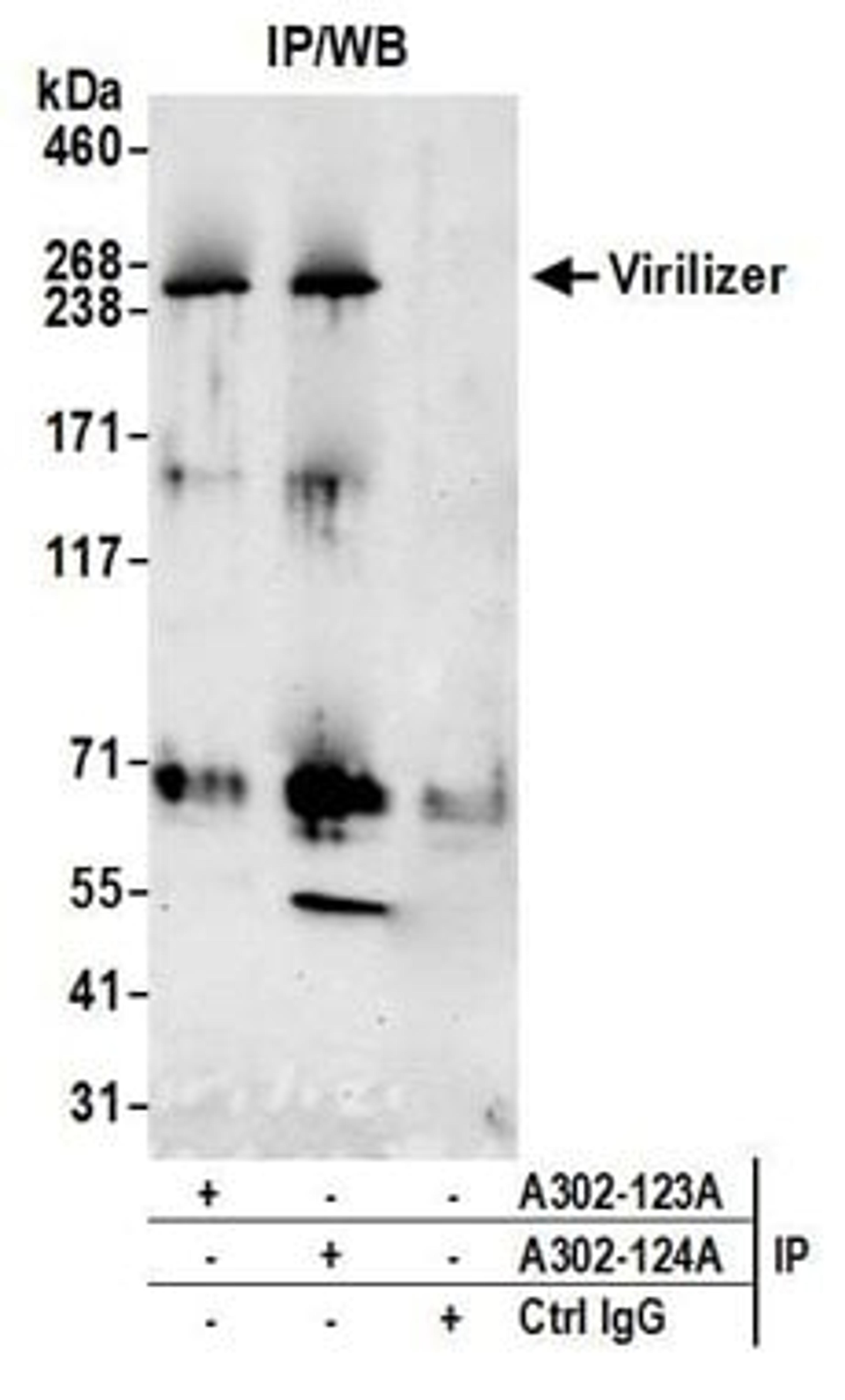 Detection of human Virilizer by western blot of immunoprecipitates.