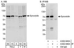 Detection of human and mouse Synoviolin by western blot (h&m) and immunoprecipitation (h).