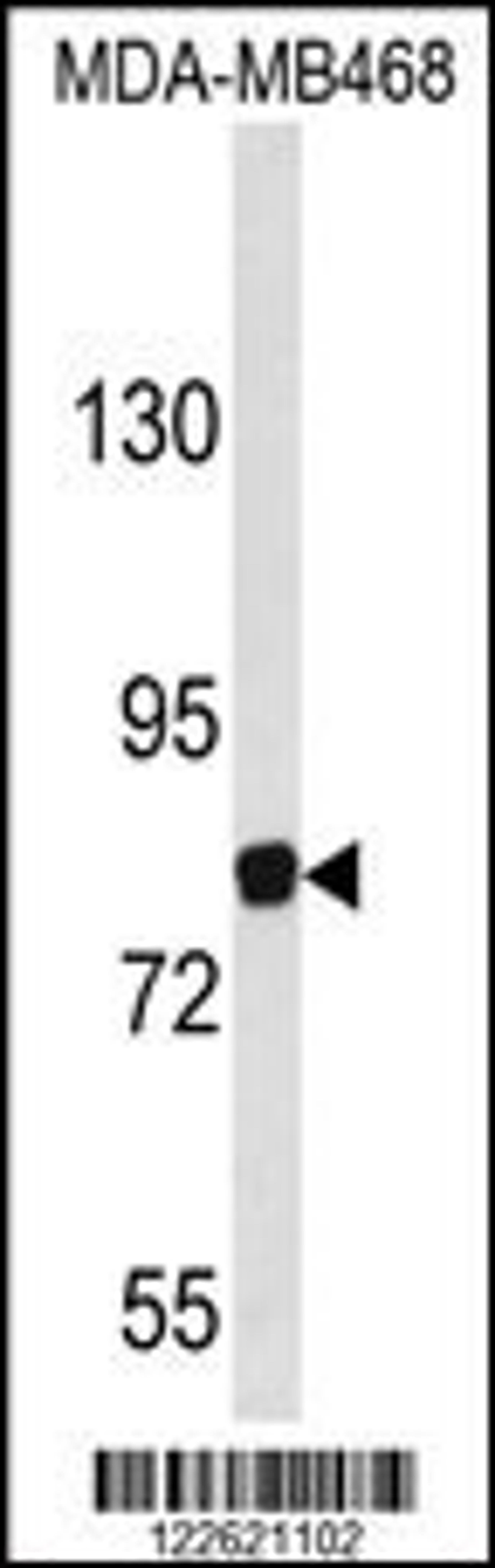 Western blot analysis of EVI5 Antibody in MDA-MB468 cell line lysates (35ug/lane)