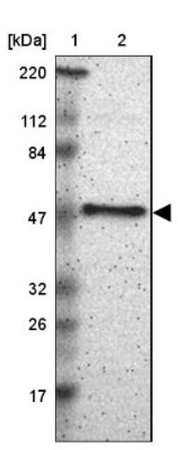 Western Blot: SCAP2 Antibody [NBP2-47288] - Lane 1: Marker [kDa] 220, 112, 84, 47, 32, 26, 17.  Lane 2: Human cell line RT-4