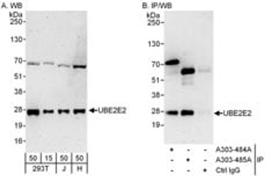 Detection of human UBE2E2 by western blot and immunoprecipitation.