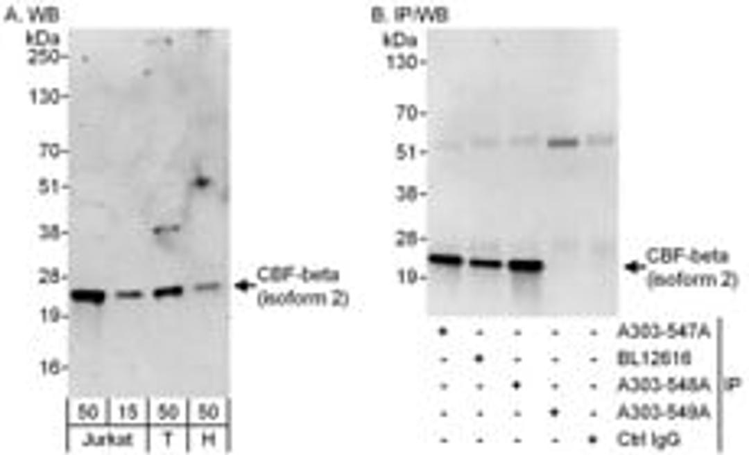 Detection of Isoform 2 of human CBF-beta by western blot and immunoprecipitation.