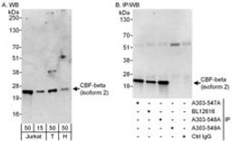 Detection of Isoform 2 of human CBF-beta by western blot and immunoprecipitation.