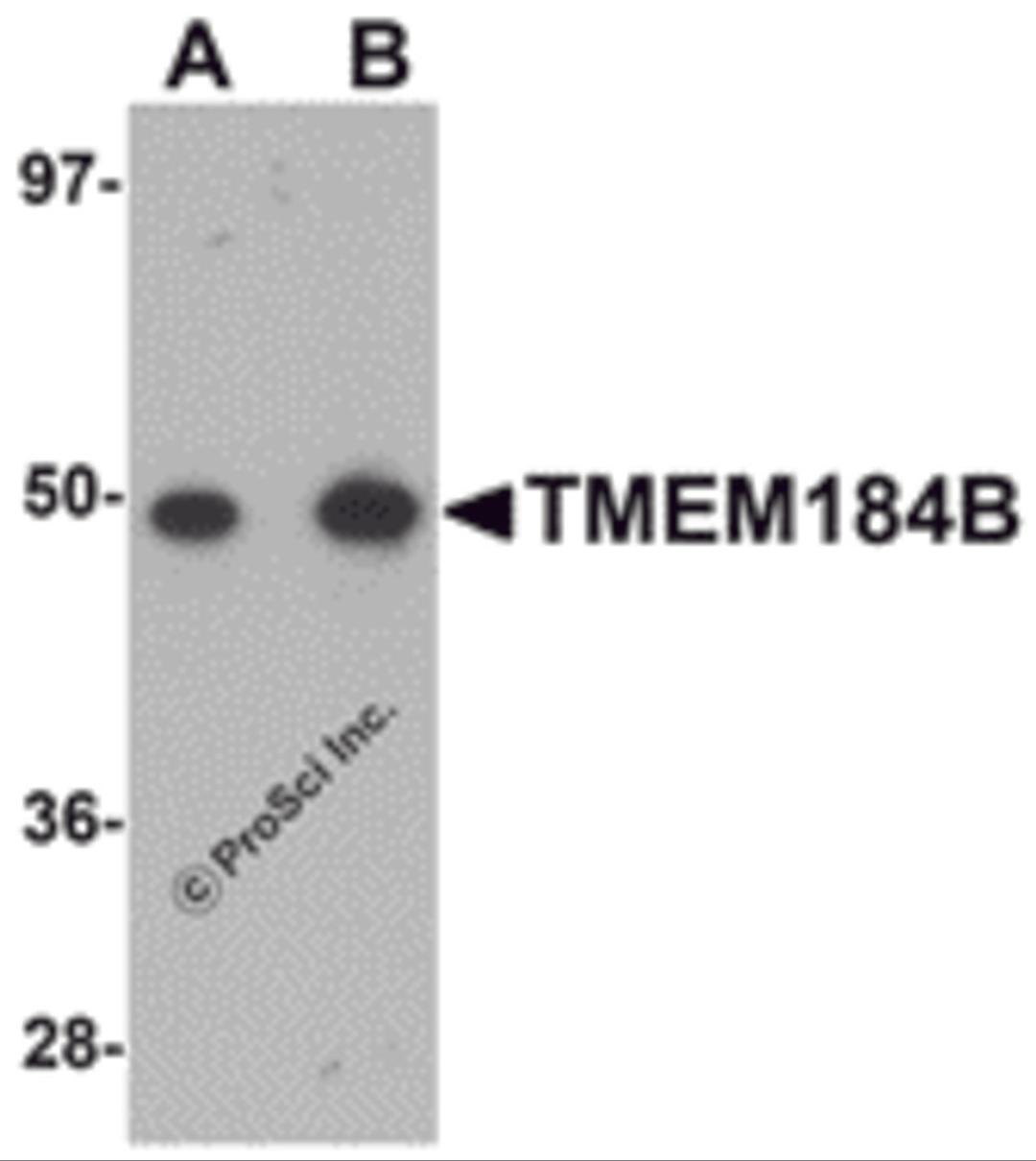 Western blot analysis of TMEM184B in rat lung tissue lysate with TMEM184B antibody at (A) 1 and (B) 2 μg/mL.