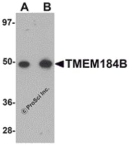 Western blot analysis of TMEM184B in rat lung tissue lysate with TMEM184B antibody at (A) 1 and (B) 2 μg/mL.