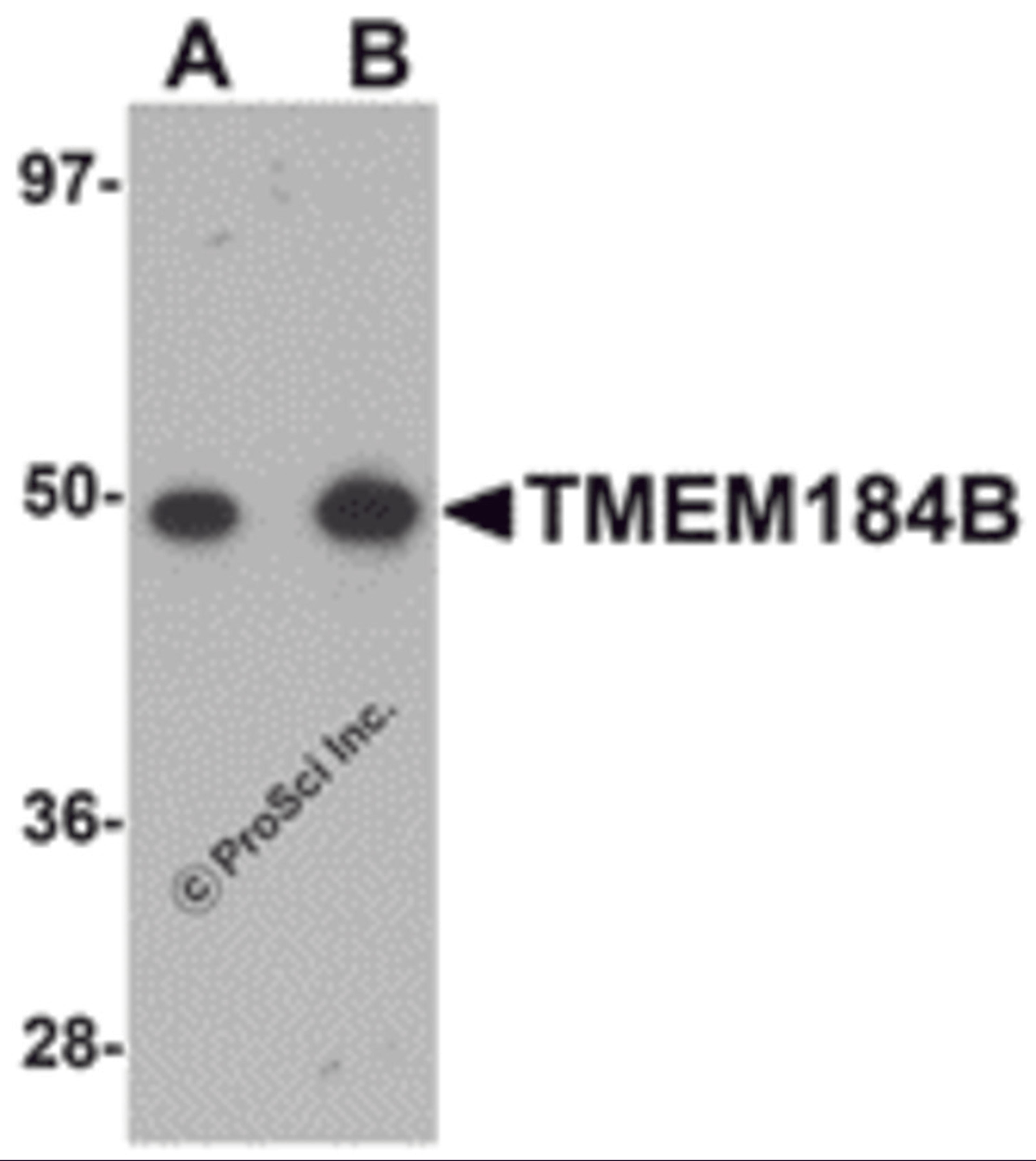 Western blot analysis of TMEM184B in rat lung tissue lysate with TMEM184B antibody at (A) 1 and (B) 2 μg/mL.