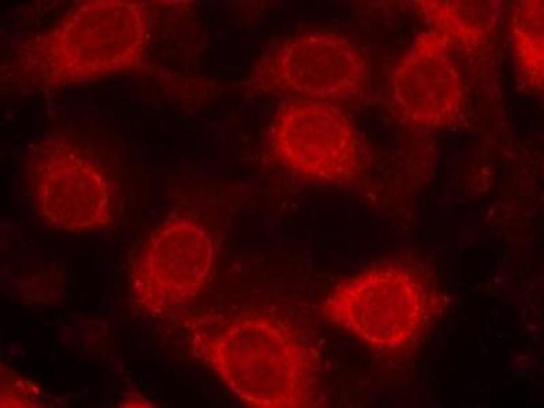 Immunocytochemistry/Immunofluorescence: eIF4E [p Ser209] Antibody [NB100-81898] - Staining of methanol-fixed MCF cells using eIF4E(Phospho-Ser209) antibody