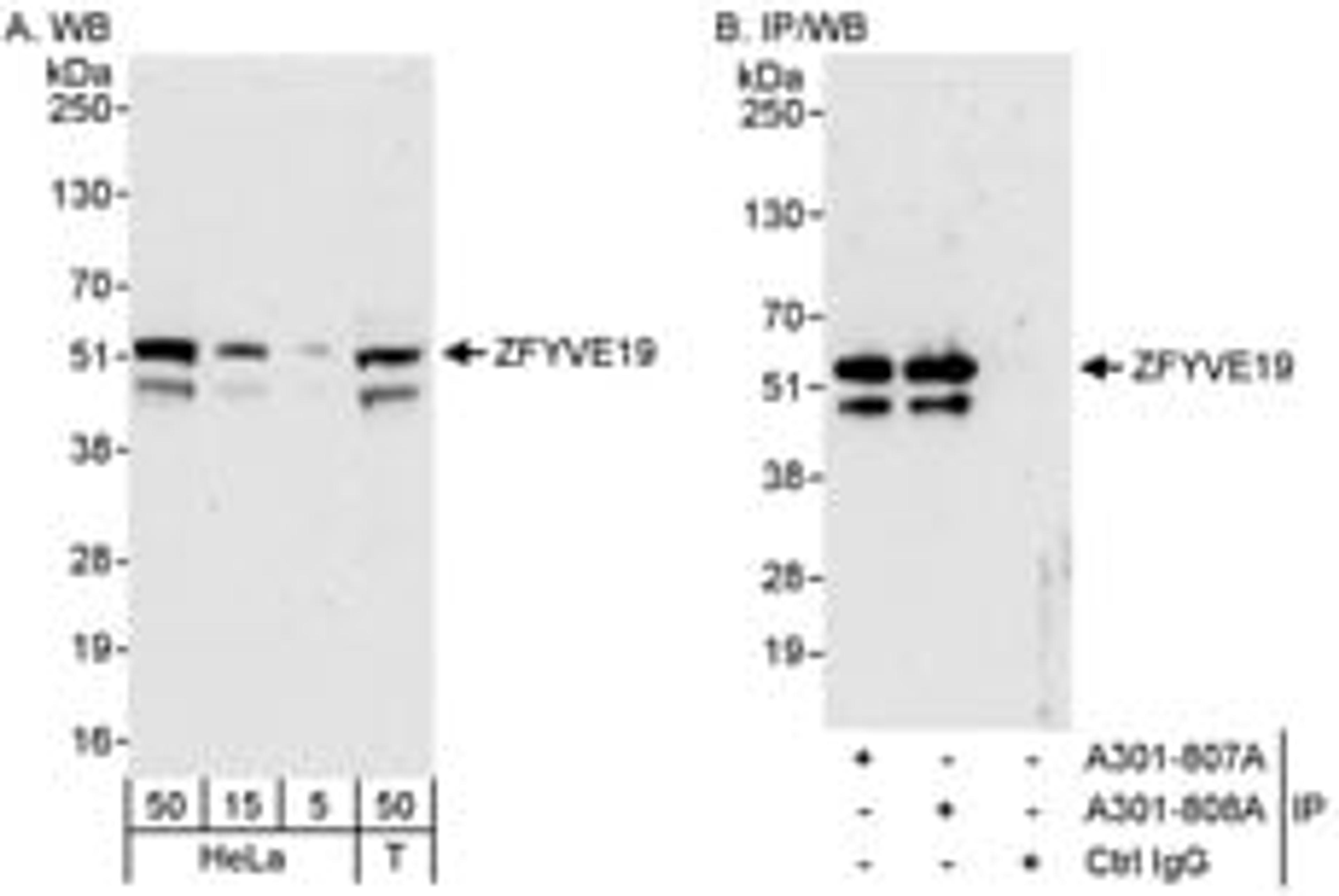 Detection of human ZFYVE19 by western blot and immunoprecipitation.