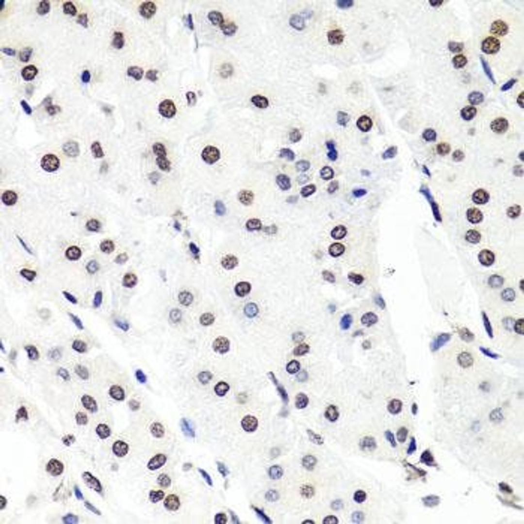 Immunohistochemical staining of mouse brain tissue using HIST1H2BG antibody (dilution of 1:100)