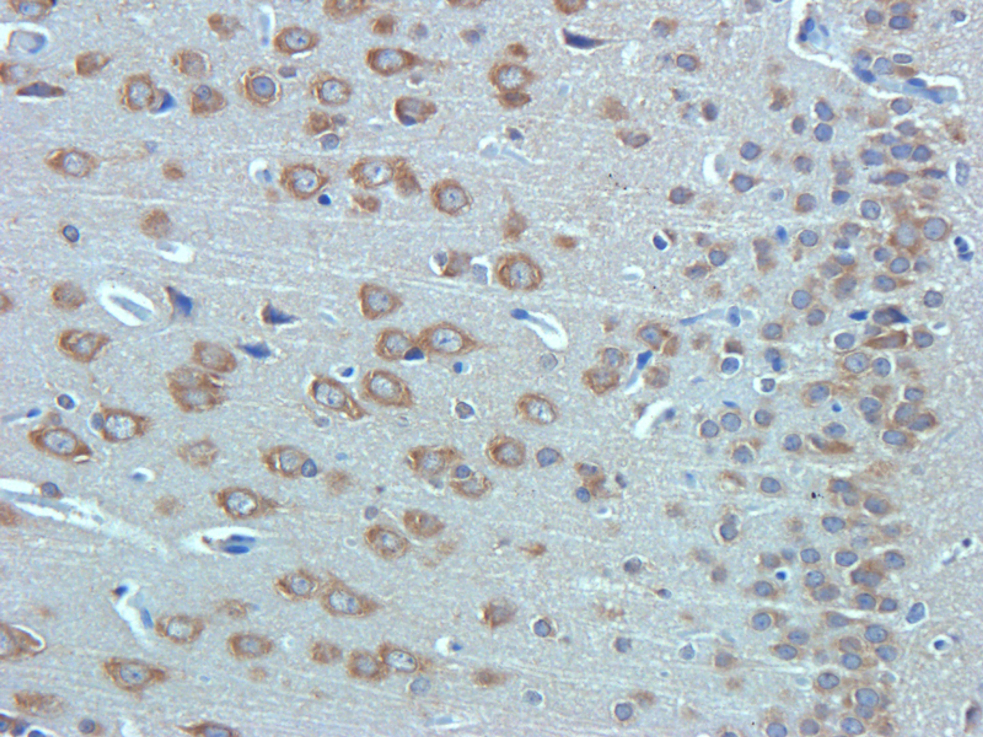 IHC-P staining of rat brain tissue using Substance P antibody (2.5 ug/ml)