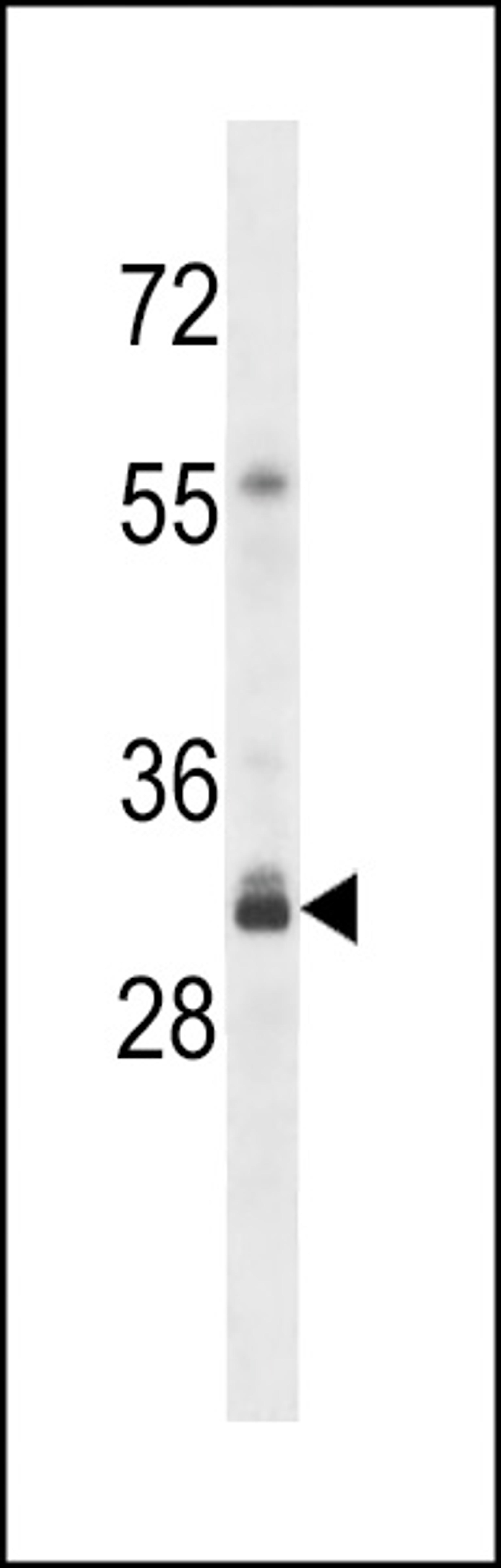 Western blot analysis in Y79 cell line lysates (35ug/lane).