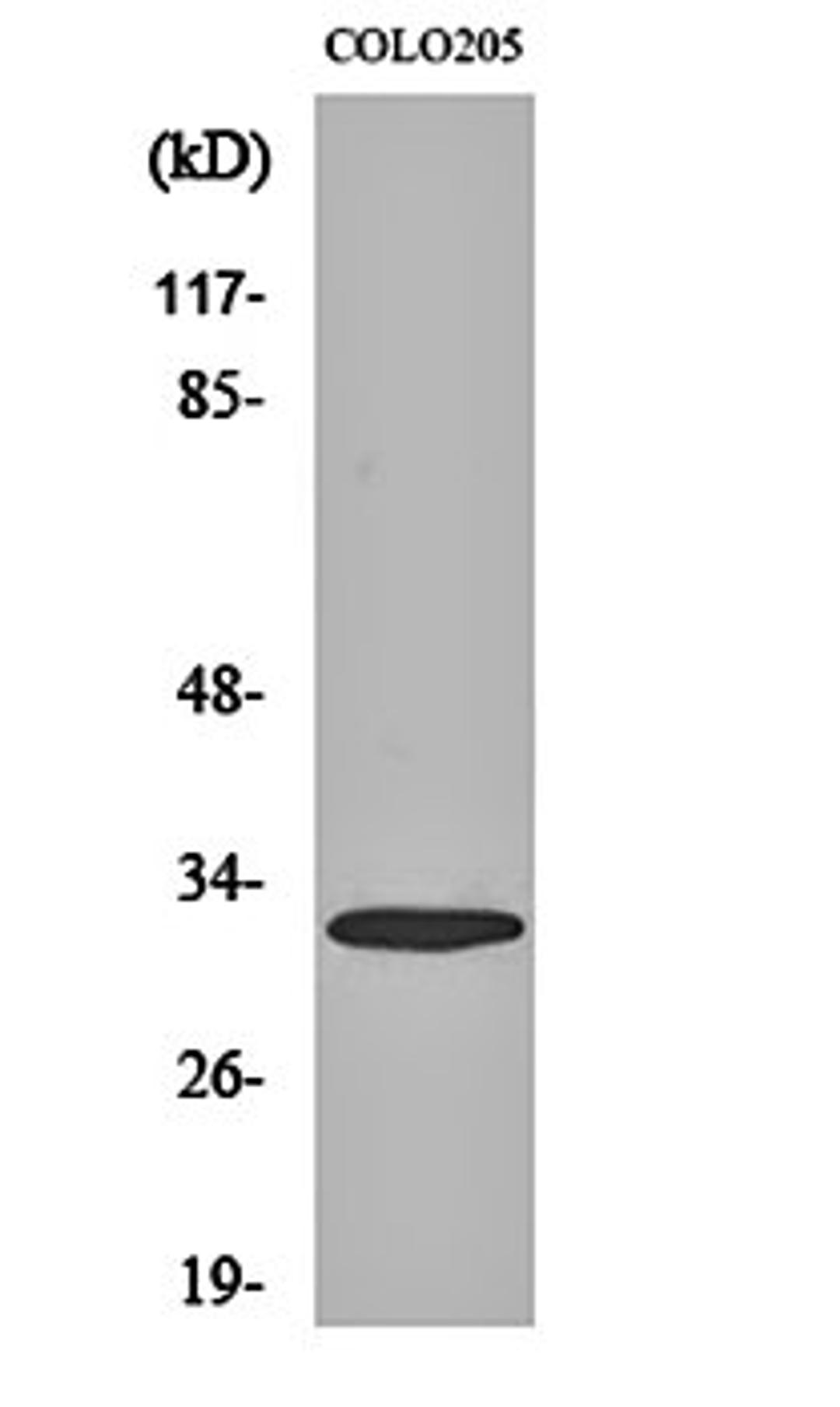 Western blot analysis of COLO205 cell lysates using APHC antibody