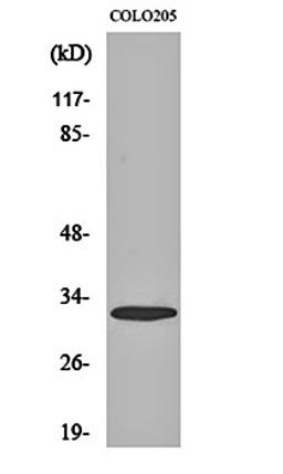 Western blot analysis of COLO205 cell lysates using APHC antibody