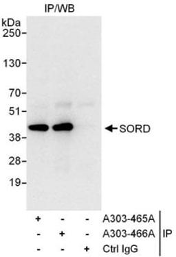 Detection of human SORD by western blot of immunoprecipitates.