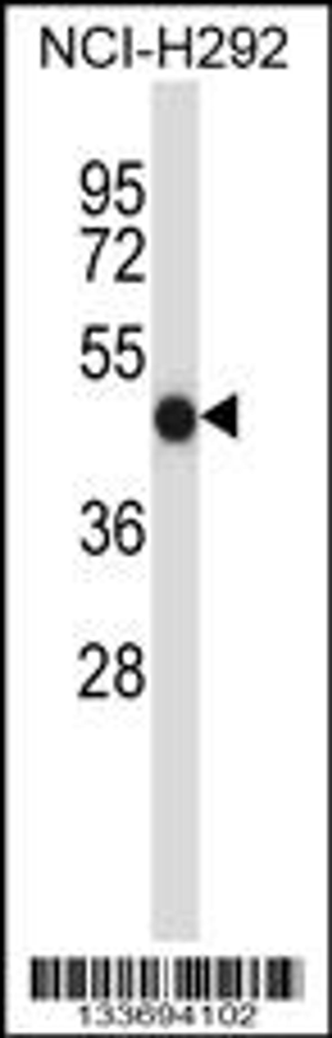 Western blot analysis in NCI-H292 cell line lysates (35ug/lane).