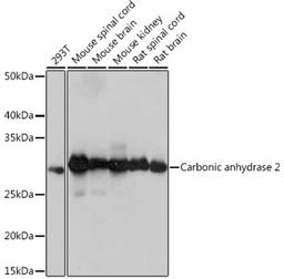 Western blot - Carbonic anhydrase 2 Rabbit mAb (A9148)