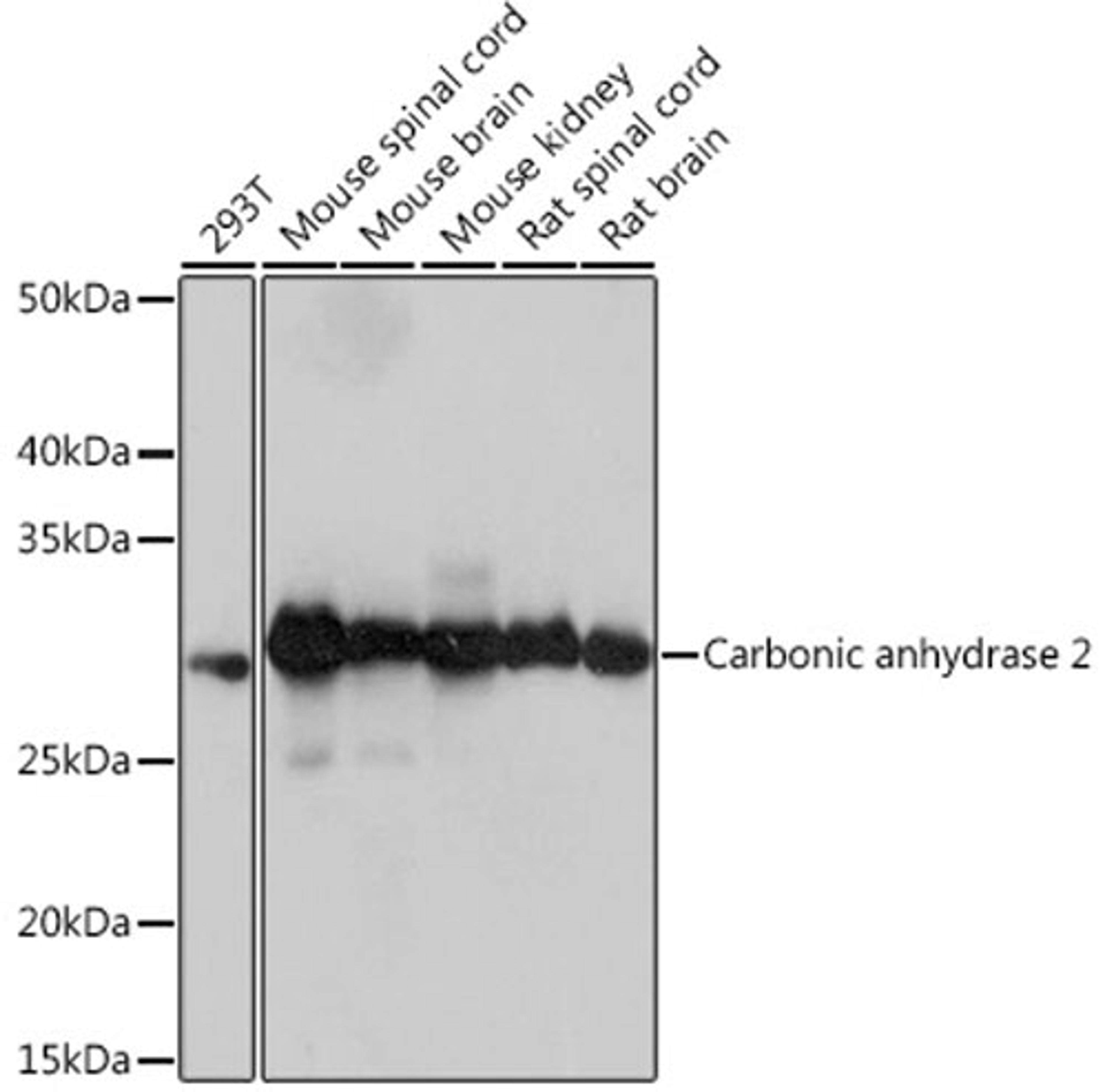 Western blot - Carbonic anhydrase 2 Rabbit mAb (A9148)