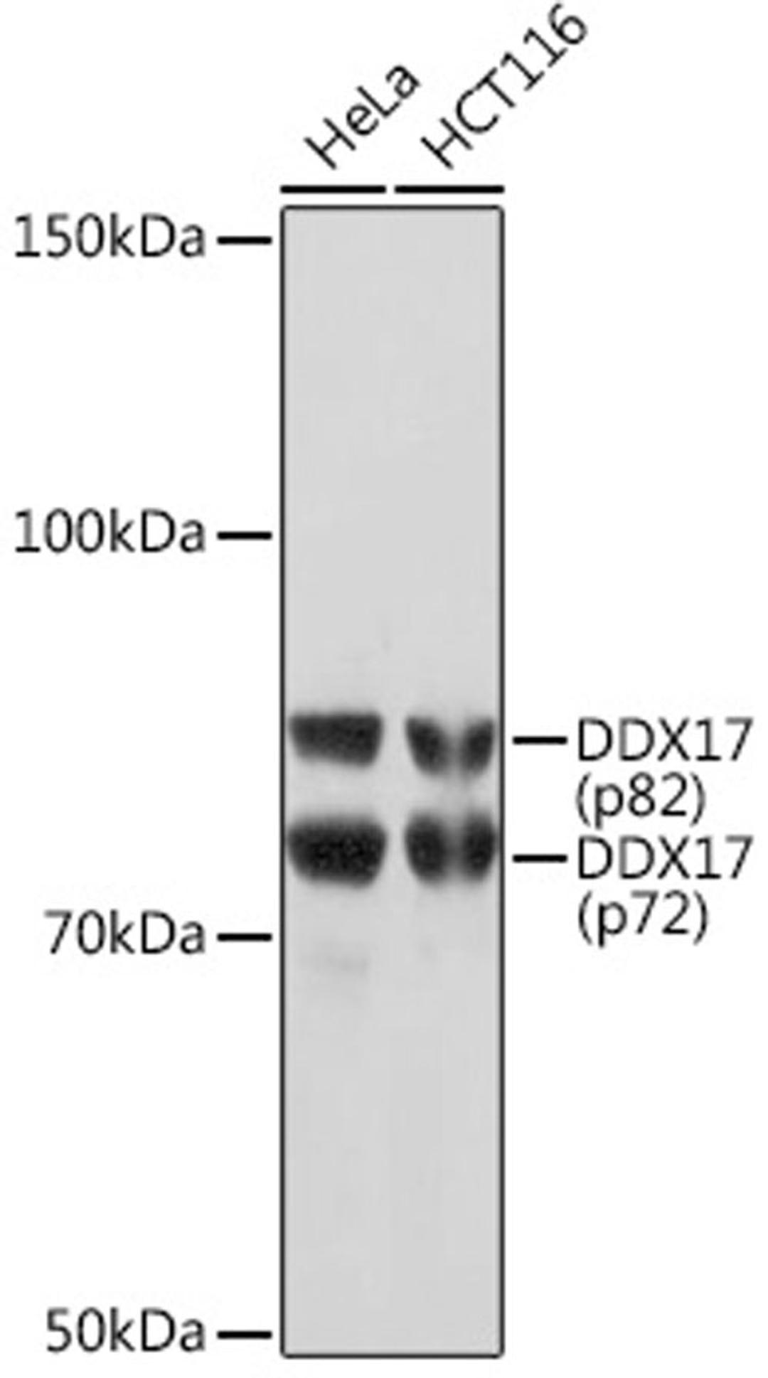 Western blot - DDX17 Rabbit mAb (A5731)