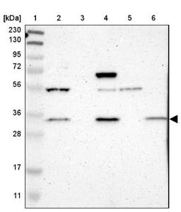 Western Blot: FAM49B Antibody [NBP1-88582] - Lane 1: Marker [kDa] 230, 130, 95, 72, 56, 36, 28, 17, 11<br/>Lane 2: Human cell line RT-4<br/>Lane 3: Human plasma (IgG/HSA depleted)<br/>Lane 4: Human cell line U-251MG sp<br/>Lane 5: Human liver tissue<br/>Lane 6: Human tonsil tissue